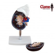 MODELO DE RIM COM GLÂNDULA SUPRA-RENAL EM TAMANHO NATURAL